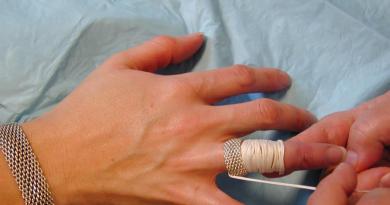 Kako skinuti prsten sa bolnog prsta, prijaviti uputstva Veoma natečen prst, kako skinuti prsten